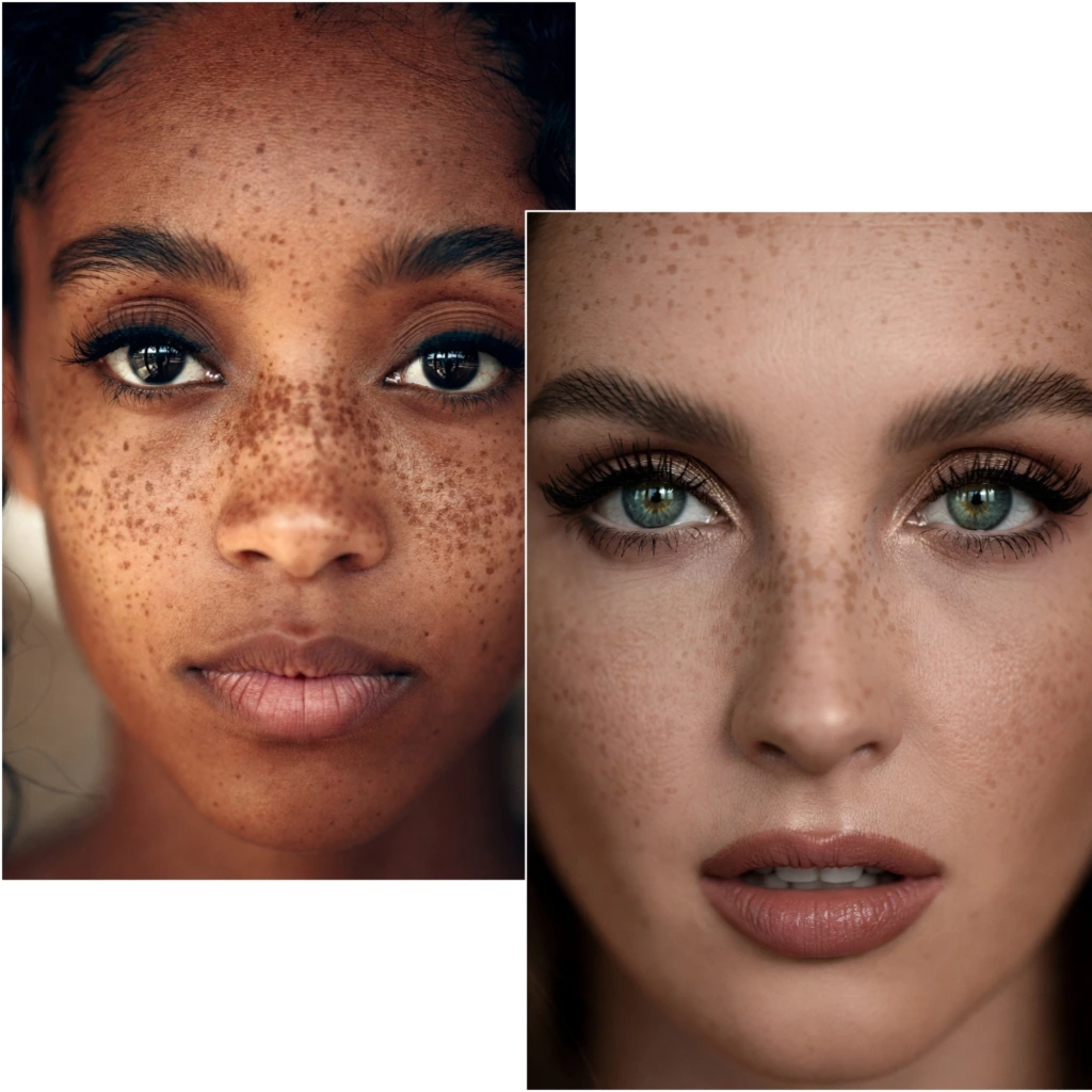 freckles models (9)